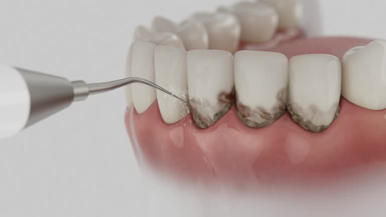 Trusted Teeth Cleaning And Checkup service in Rosaryville, MD - Dentist Open Now
